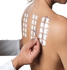 Image illustrating Patch Test