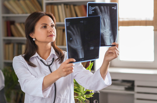 Female doctor examining X-ray