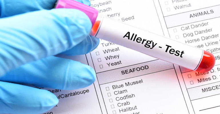 Illustration of Allergy Blood Test Procedure