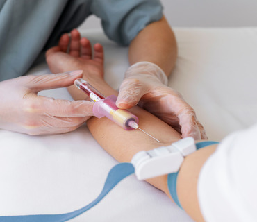 Laboratory Technician Performing Allergy Blood Test