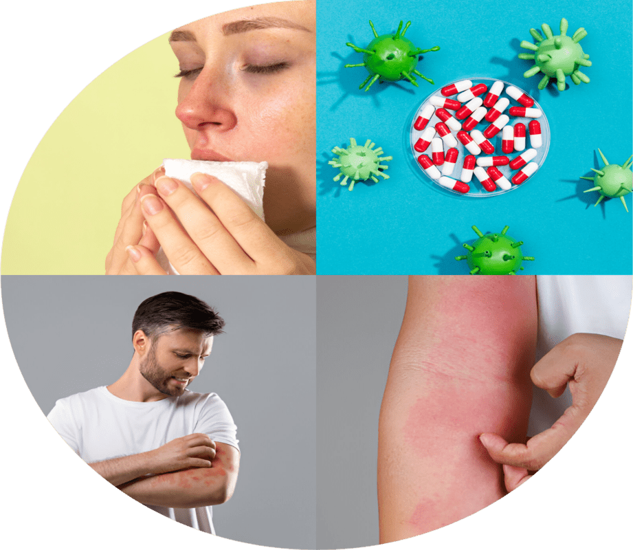 Allergy care specialists