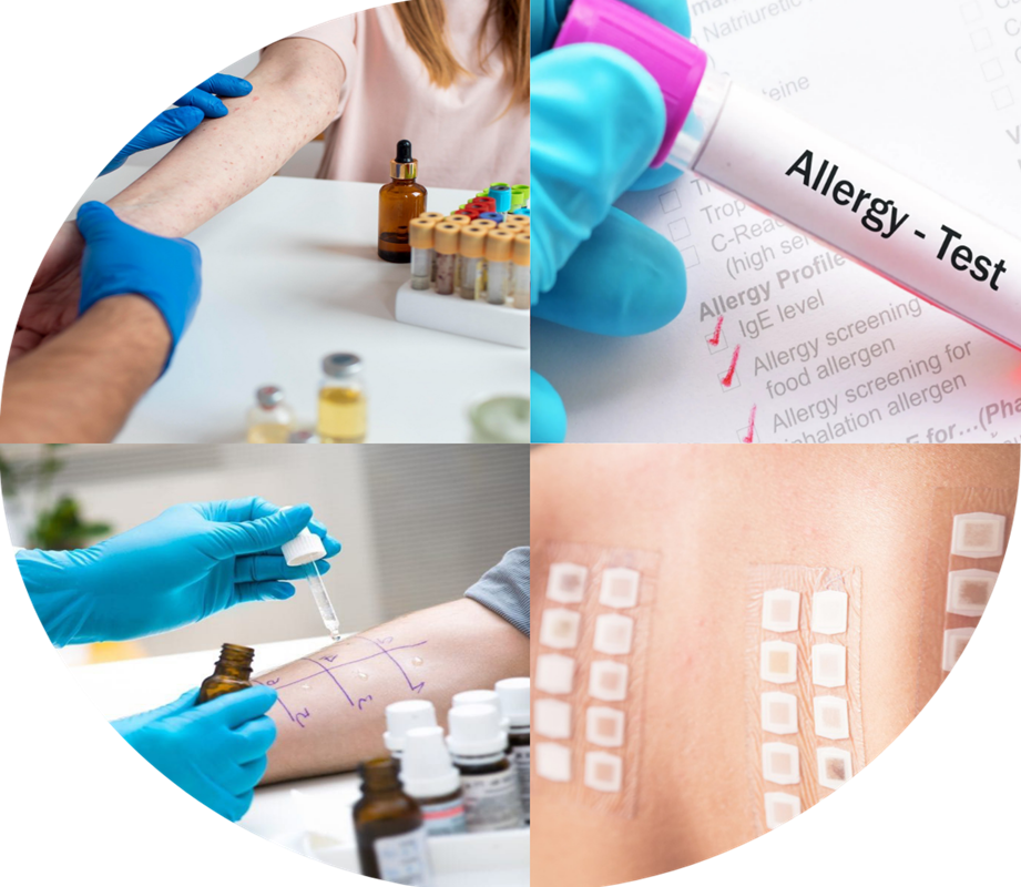 Overview of allergy tests